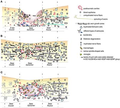 Human Umbilical Cord Blood Cell Transplantation in Neuroregenerative Strategies